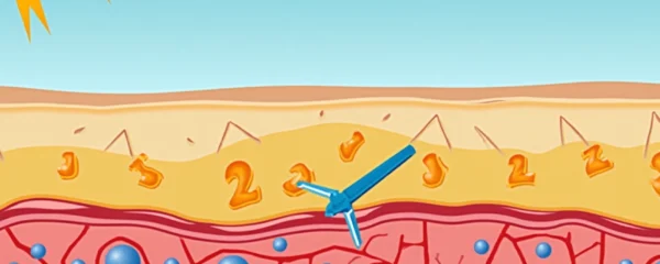 en-quoi-les-rayons-uvb-sont-ils-differents-des-uva-et-pourquoi-faut-il-s-en-proteger-aussi-en-hiver